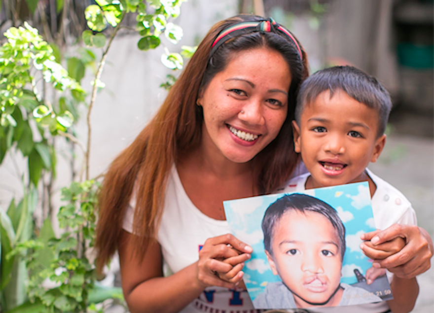 Globe teams up with Smile Train to give children with cleft lips and palates a reason to smile | Cebu Finest